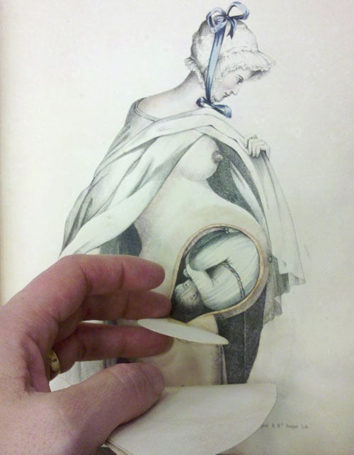pregnantbonnet